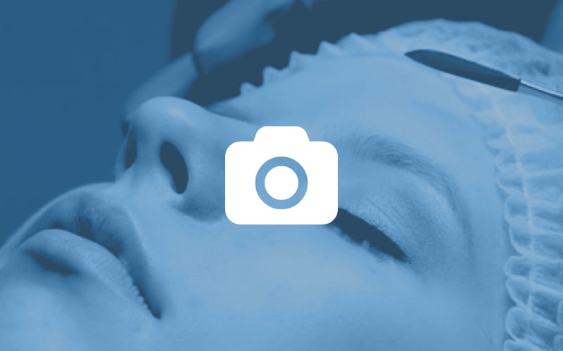 Фотографии